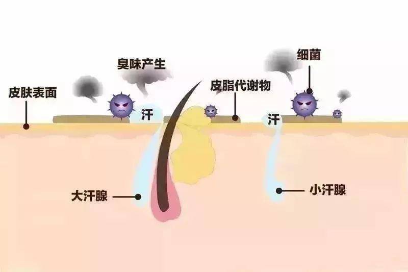 腋臭最新技术，迈向无臭新生活